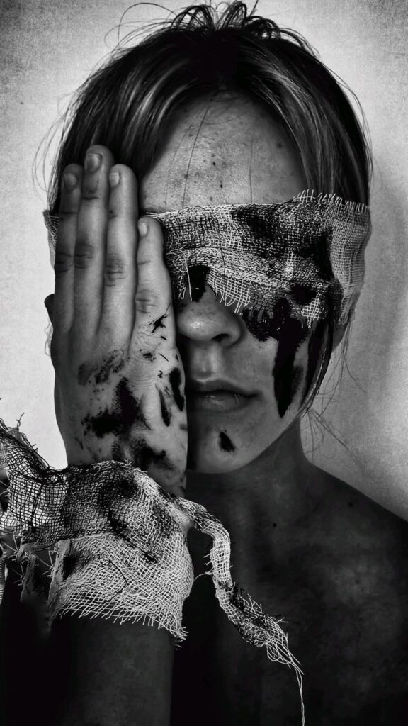 When Love Leaves Bruises: Understanding Domestic Violence and Physical Abuse