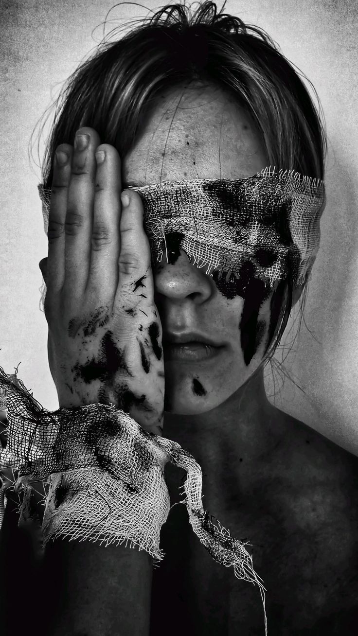 When Love Leaves Bruises: Understanding Domestic Violence and Physical Abuse